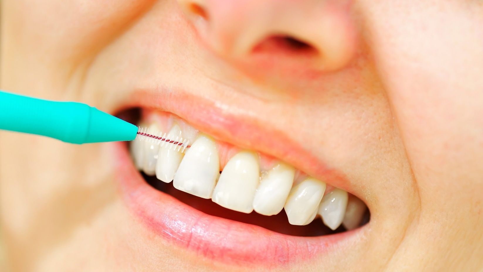 How to Choose the Right Interdental Brush Size